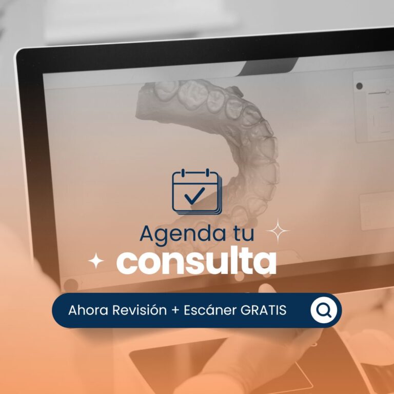 Escaner Intraoral Gratis